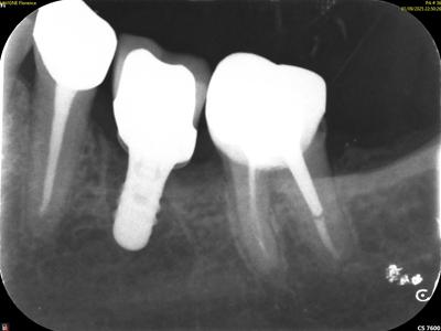 dental X-ray retouching
