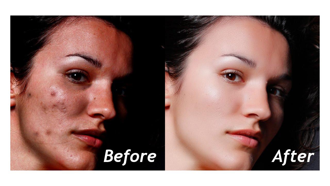 perfect retouching