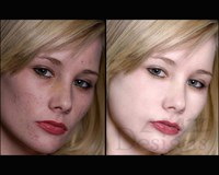 Image retouching