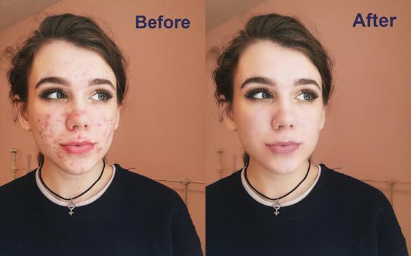 Retouching 