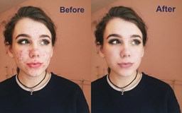 Retouching 