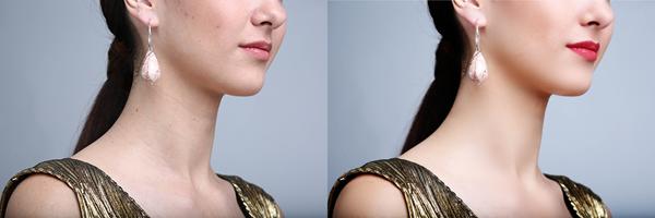 Antes y Despues