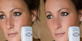Face Retouch
