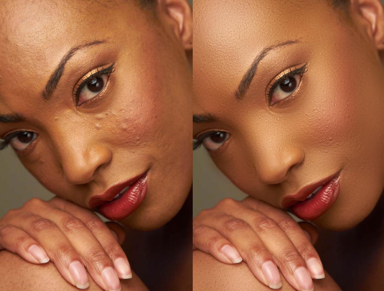 skin retouch