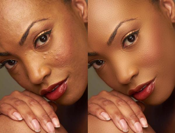 skin retouch