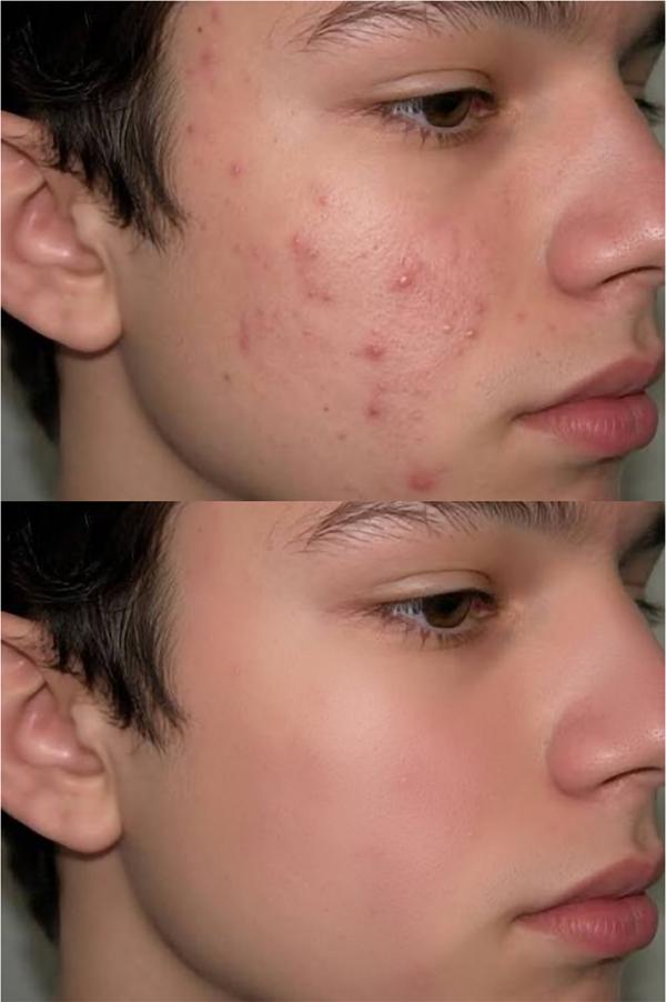 smooth skin 2k