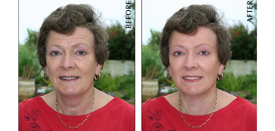Digital skin treatment for anti aging with photo retouching; no wrinkles