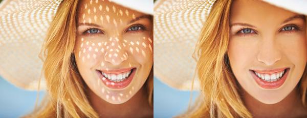 Eliminate dark spots